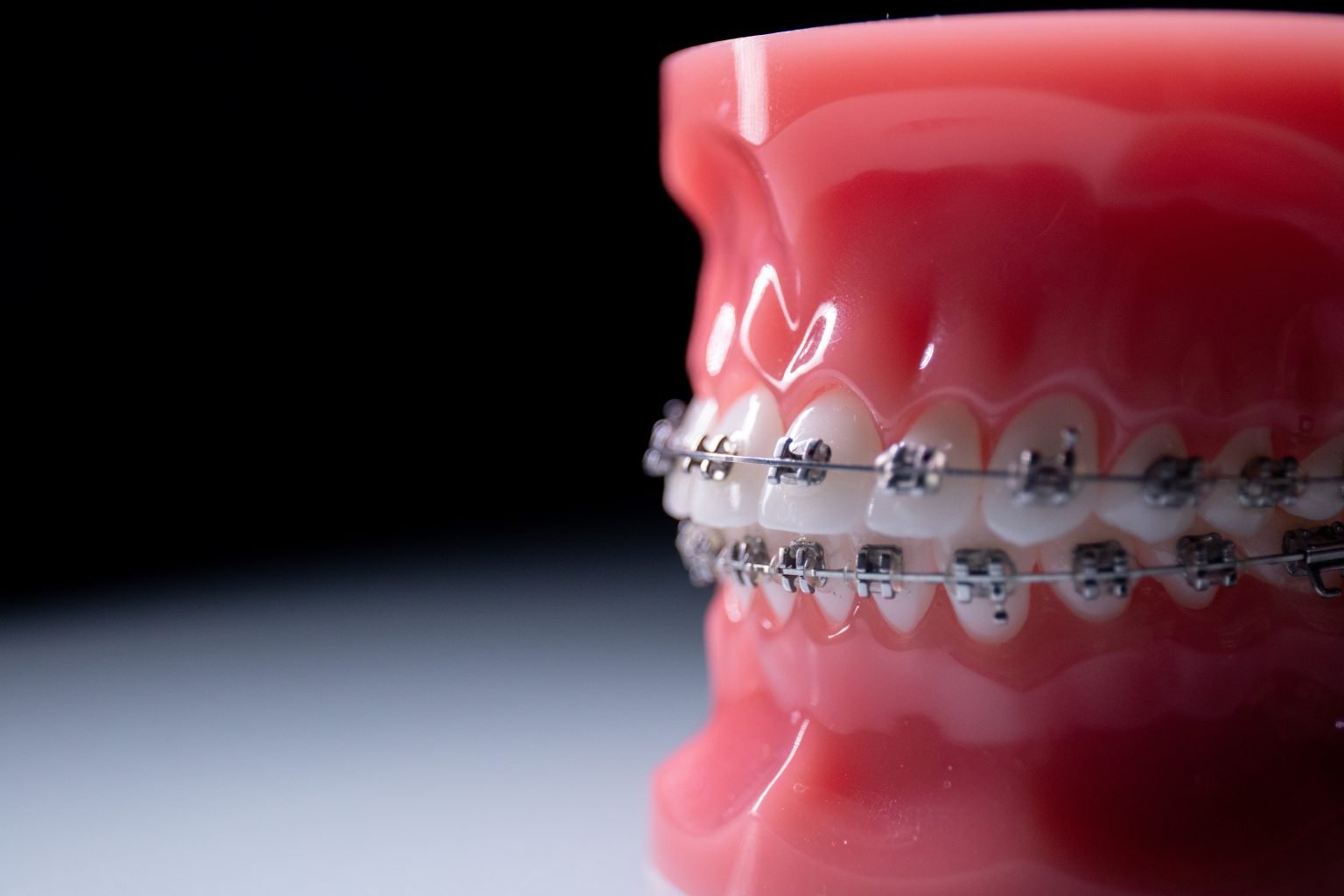 Affordable orthodontist, insurance accepted orthodontist
