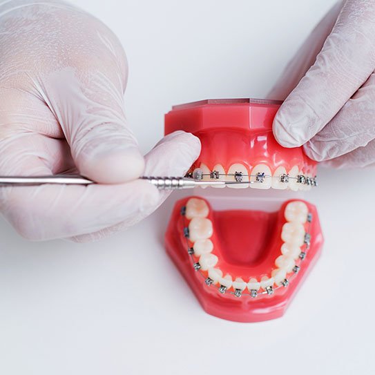 orthodontics braces
