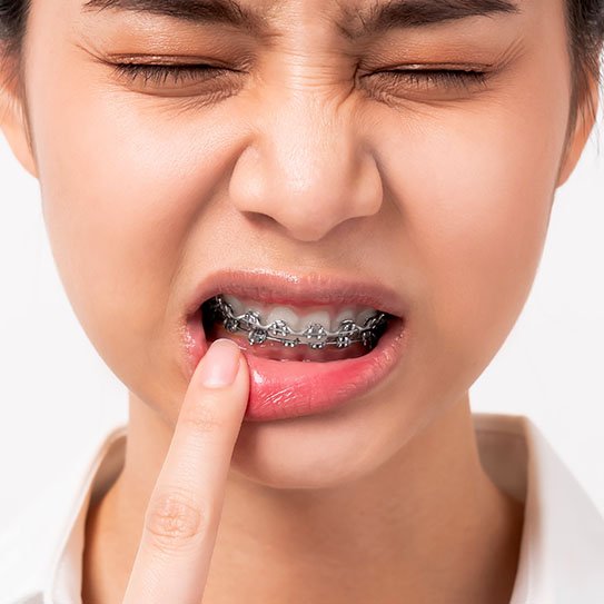 emergency orthodontics tooth pain orthodontic emergencies