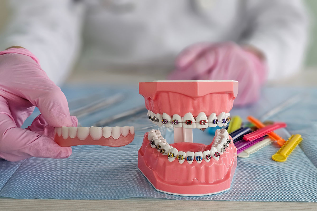 braces near me orthodontist